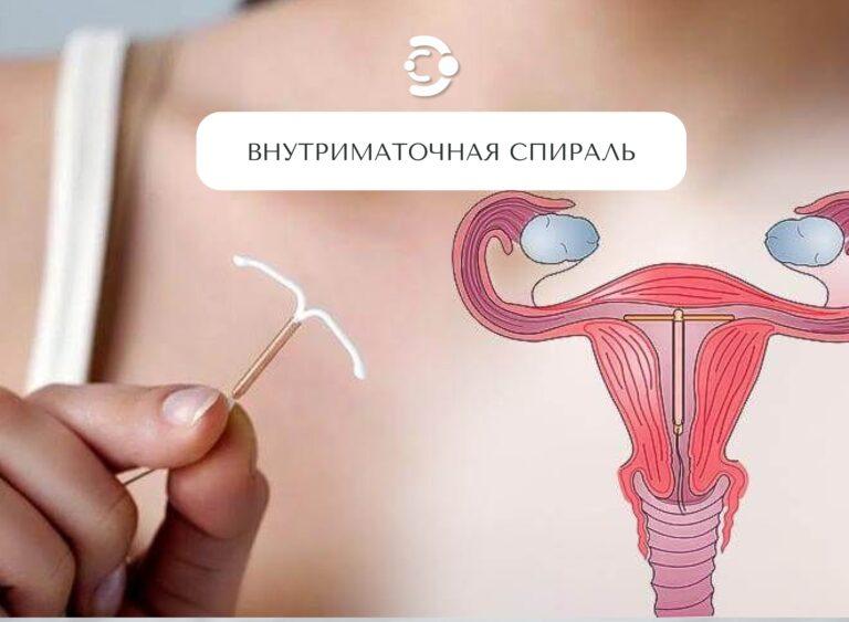vnutrimatochnye-spirali-ehffektivnoe-sredstvo-kontracepcii